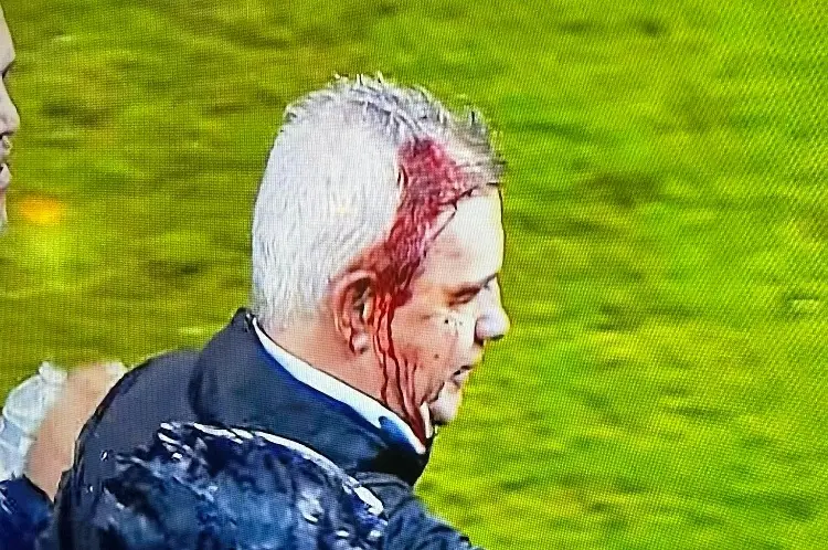 Javier Aguirre termina lleno de sangre tras la derrota de México vs Honduras 