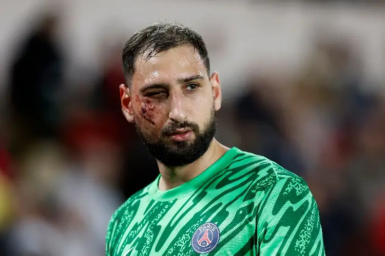 Le revientan el rostro a Donnarumma en pleno juego del PSG (VIDEO)